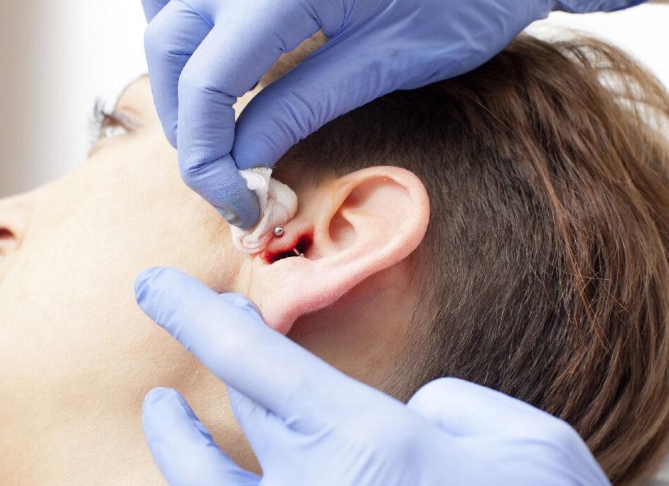 مراقبتهای بعد از انجام پیرسینگ